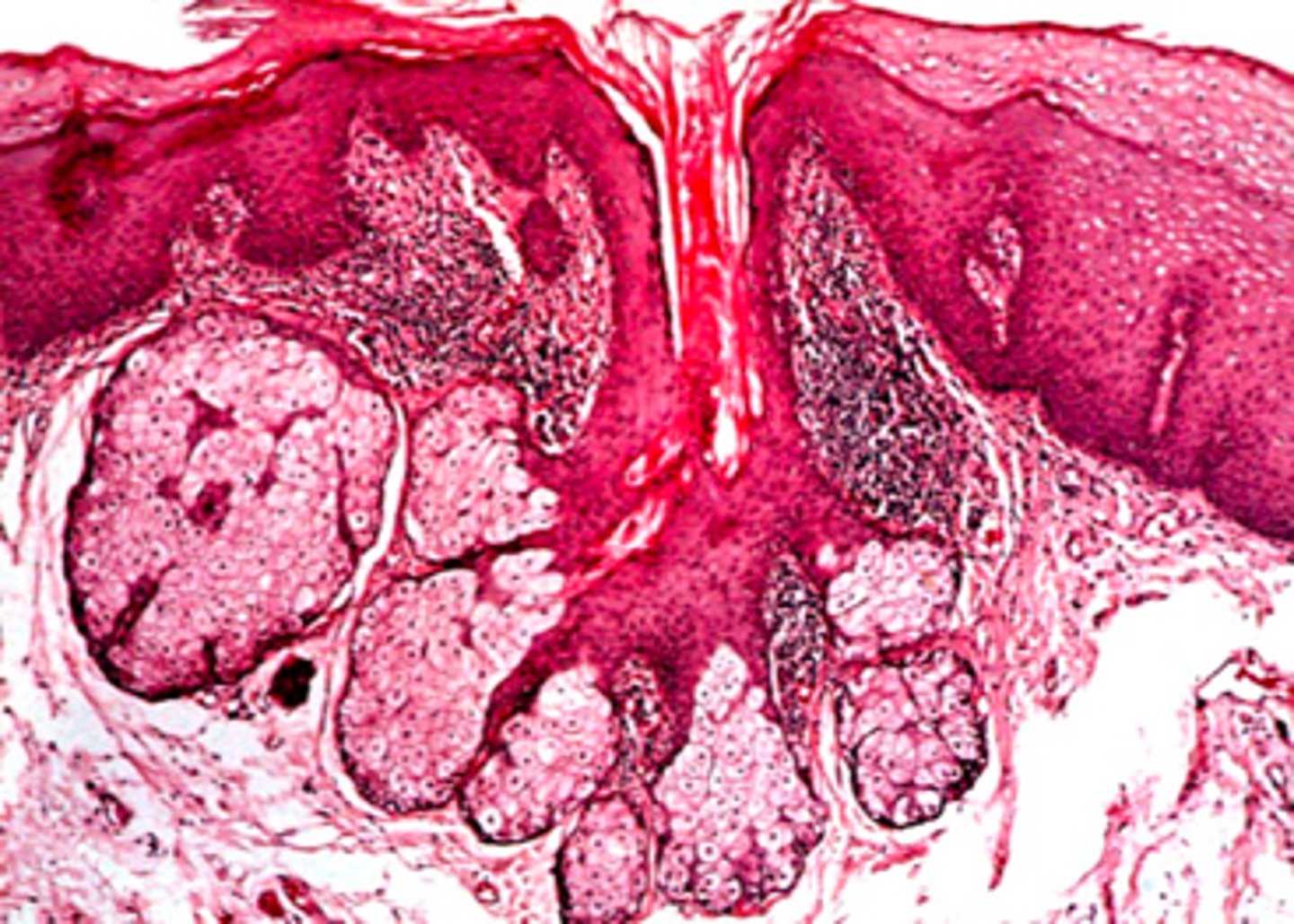 <p><em>identify the mucosa:</em></p>