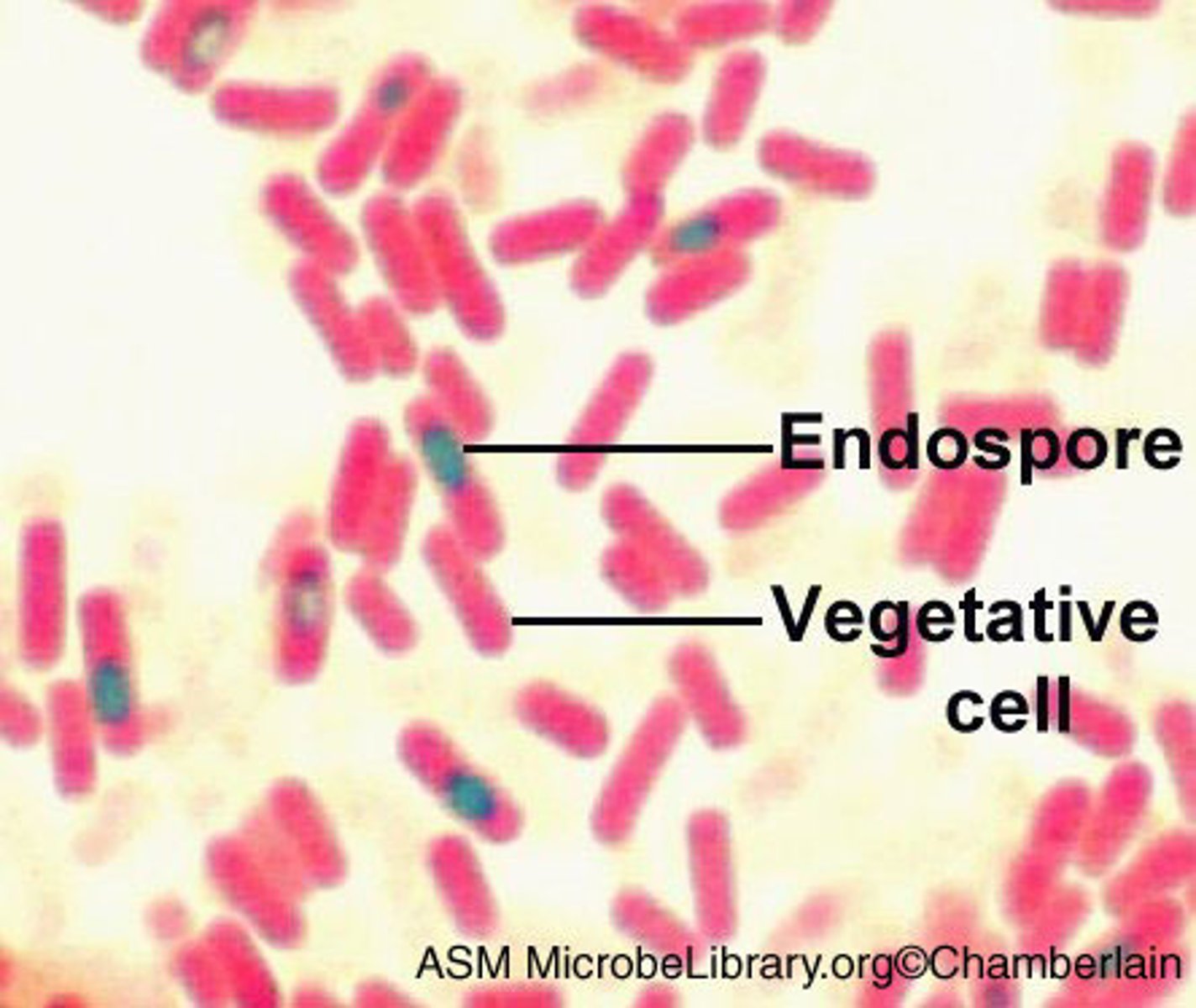 <p>CYTOPLASM stained RED</p><p>SPORES stained DARK GREEN</p>
