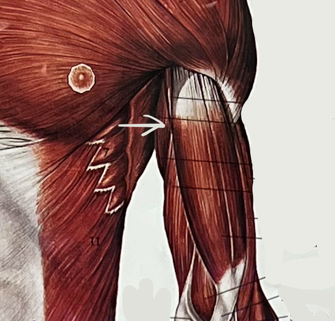 what muscle?