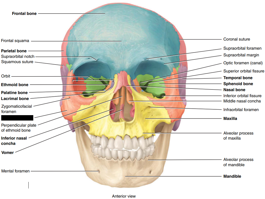 <p>State and identify which part of the cranial bone is being censored.</p>
