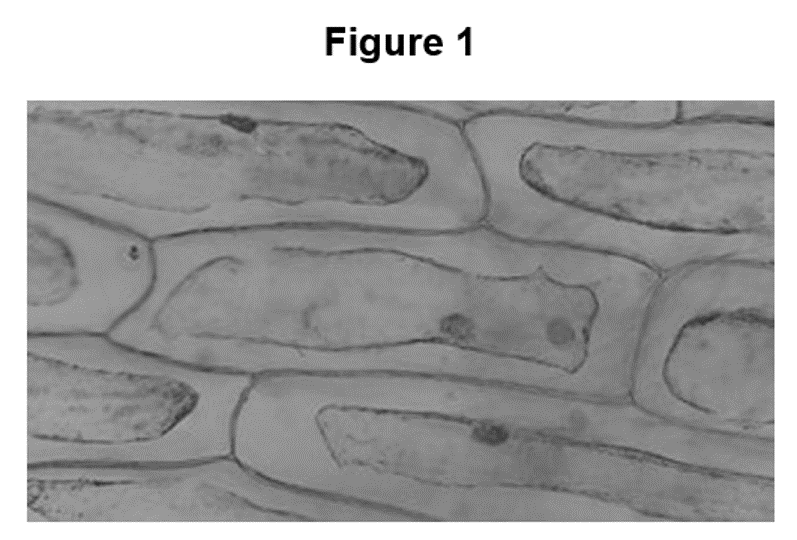 <p>Figure 1 shows an micrograph image of palisade cells from a leaf after being placed in a salt solution. (plasmolysised pic)</p><p></p><p>i)Describe and explain the appearance of the cells in Figure 1. [3 marks] </p><p>ii)Explain why the condition of the cells in Figure 1 is a problem for plants. [1 mark] </p><p>iii)Suggest how the cells in Figure 1 can return to their normal appearance. [2 marks] (6)</p>