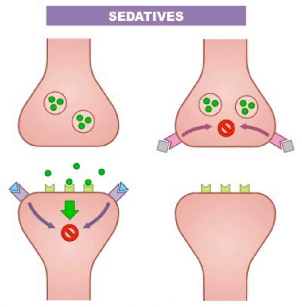 Sedatives 