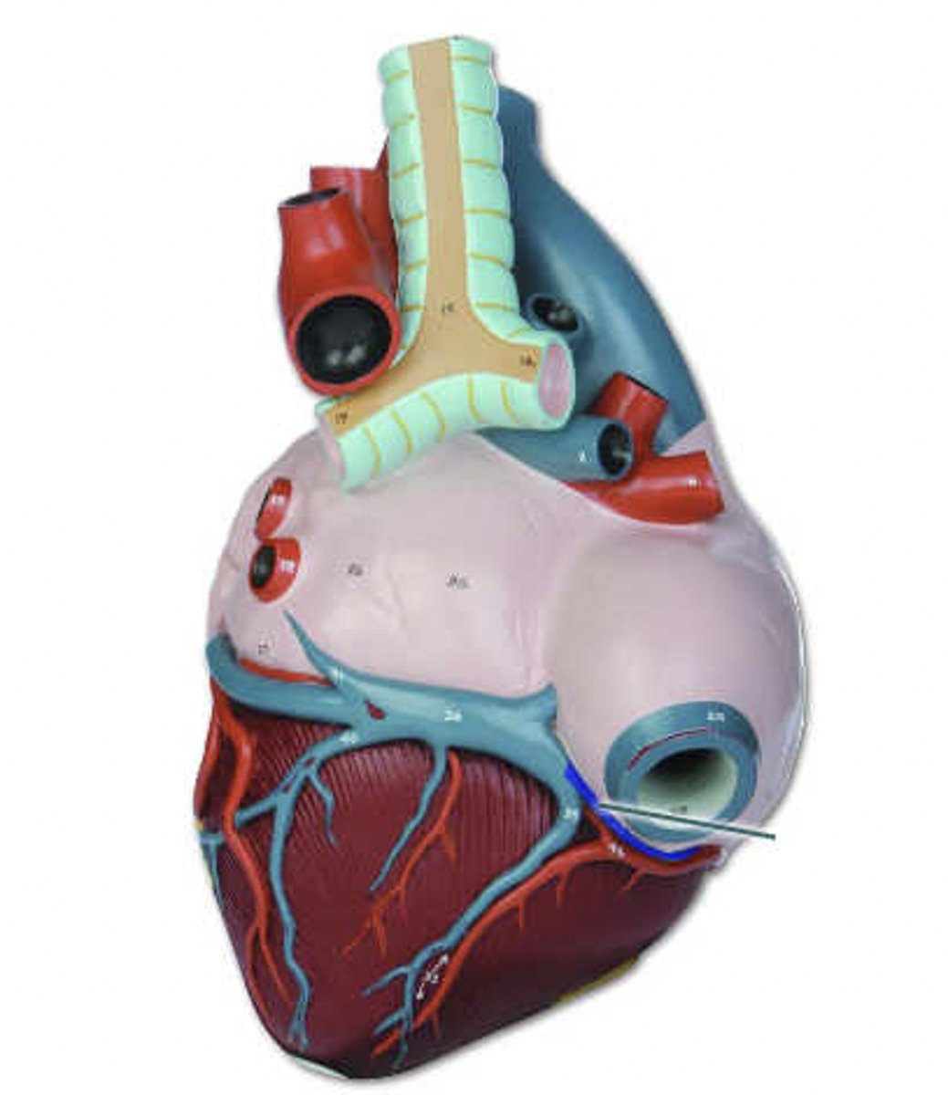 <p>identify the highlighted vessel.</p>