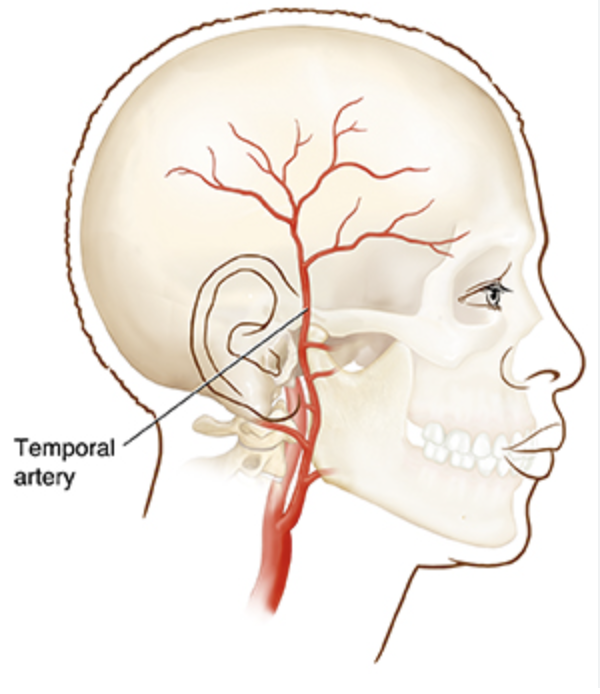 <p>head artery</p>
