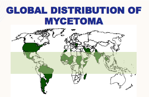 <ul><li><p><span>Found in tropical and hot temperate zones of the world</span></p></li><li><p><span>Not endemic in the USA</span></p><ul><li><p><span>Those at risk:</span></p><ul><li><p><span>Farmers / Field Workers</span></p></li><li><p><span>Sugarcane Workers</span></p></li><li><p><span>Fishermen</span></p></li></ul></li></ul></li></ul><p></p>