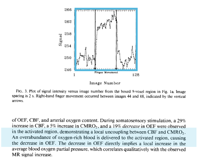 Bandettini et al. (1992)