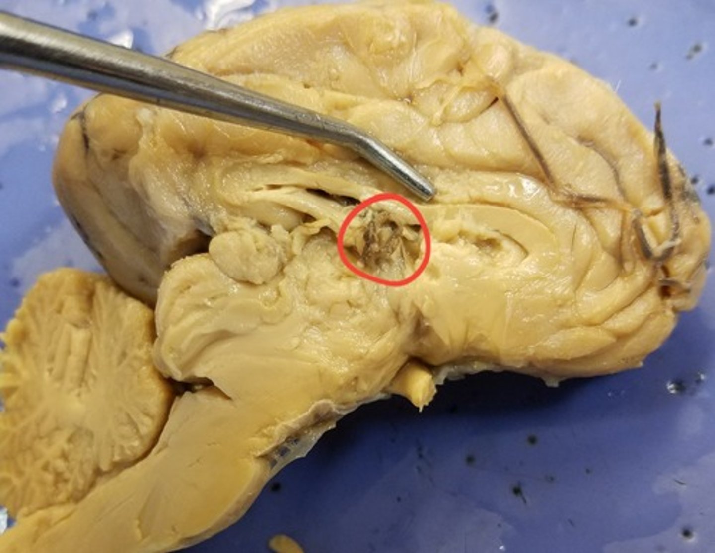 <p>Produces cerebrospinal fluid (CSF) via the ependymal cells that line the ventricles of the brain</p>