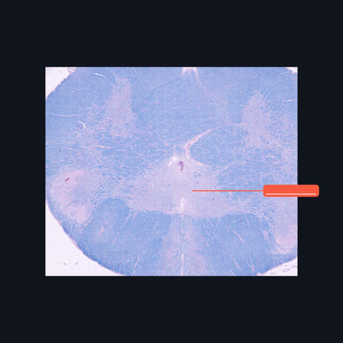 <p>Identify the pointed region in the spinal cord</p>