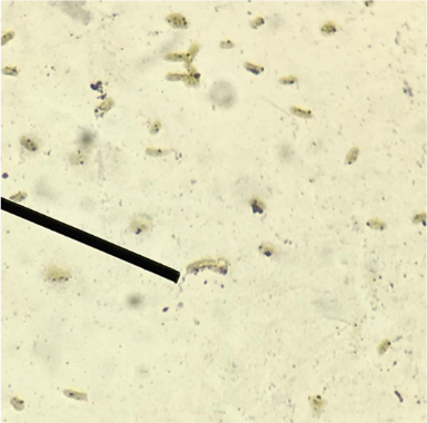 <p>Name the specific reagent necessary in the staining and demonstration of the structure pointed at.</p>