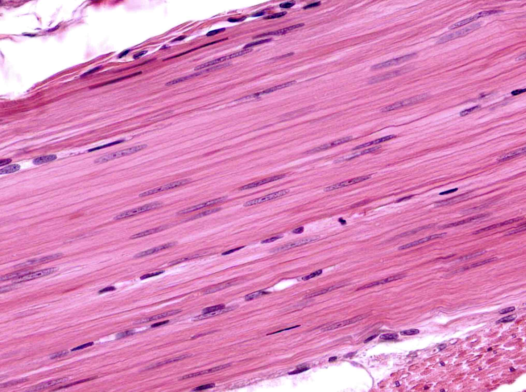 <p>What is the histology pictured?</p>