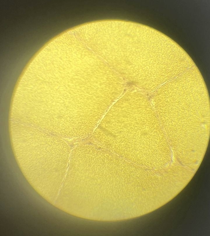 <p>Печінка</p>