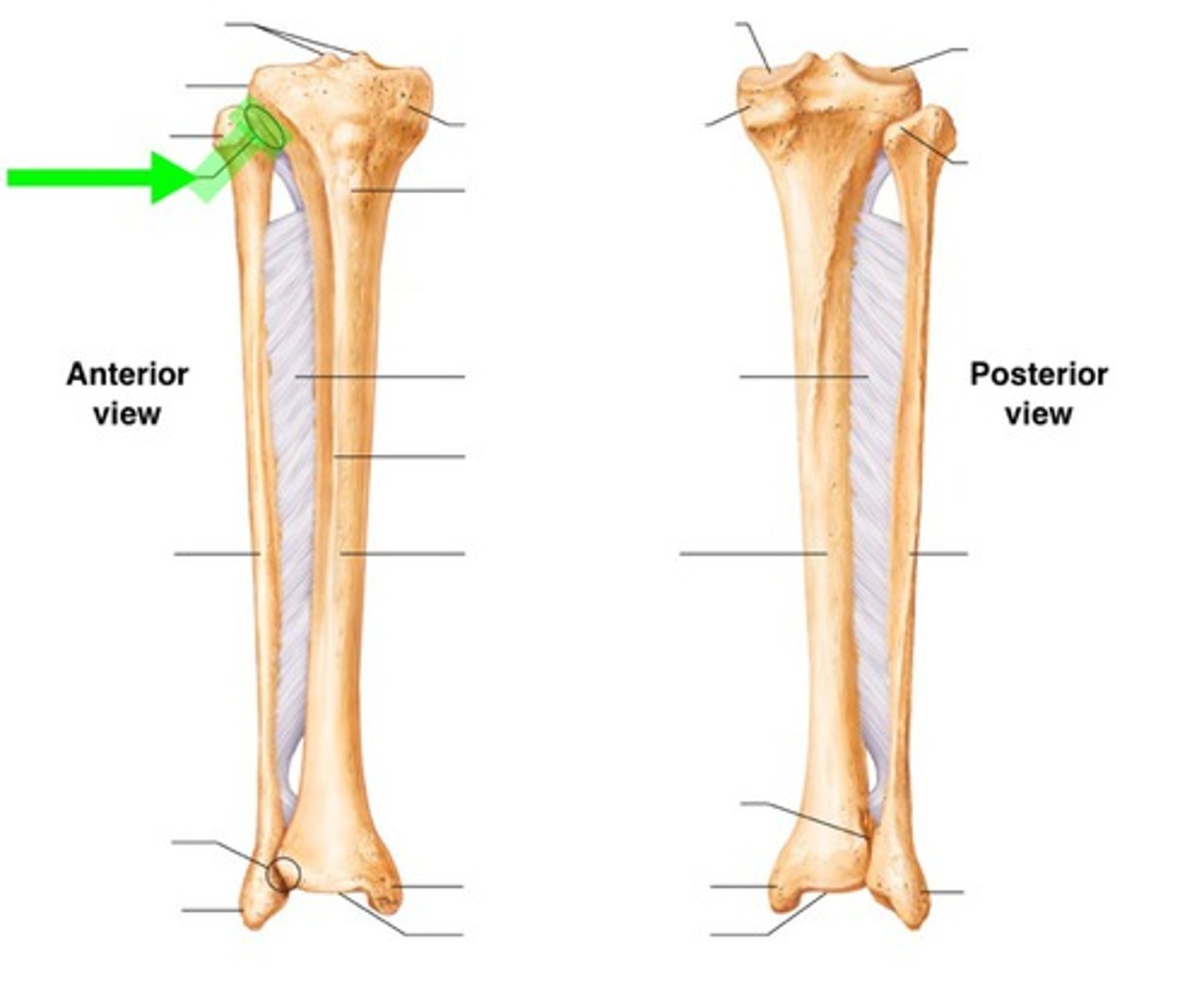 <p>Synovial joint (2 flat or slightly oval surfaces)</p>