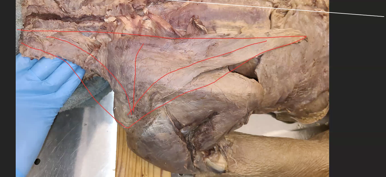 <p>the 3 heads of trapezius&nbsp;</p>