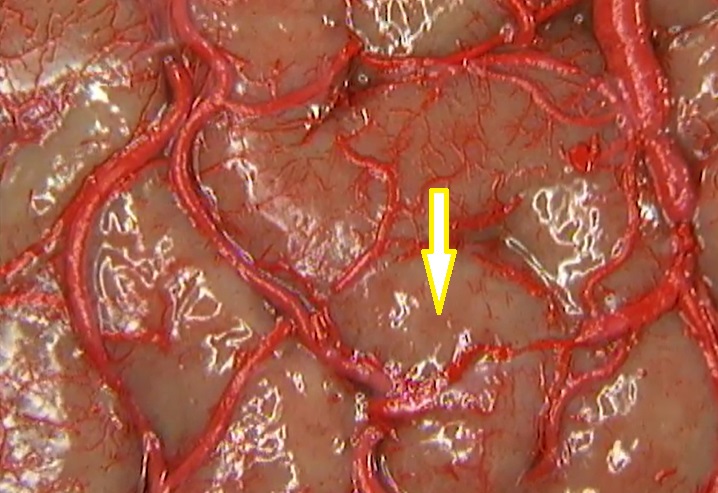 term image