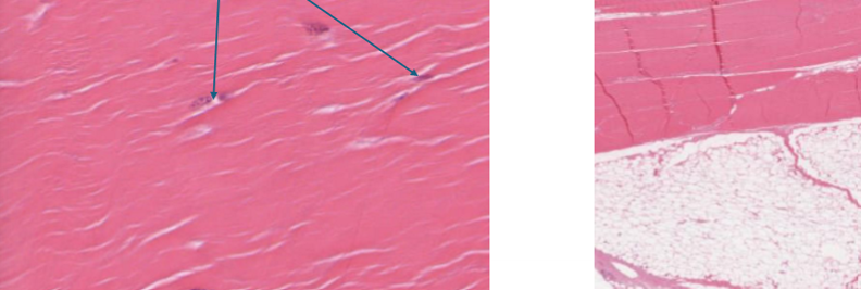 <ul><li><p>ligaments and tendons</p></li><li><p>collagen fibers in one direction</p></li><li><p>little ground matrix, occasional fibrolasts</p></li></ul><p></p>