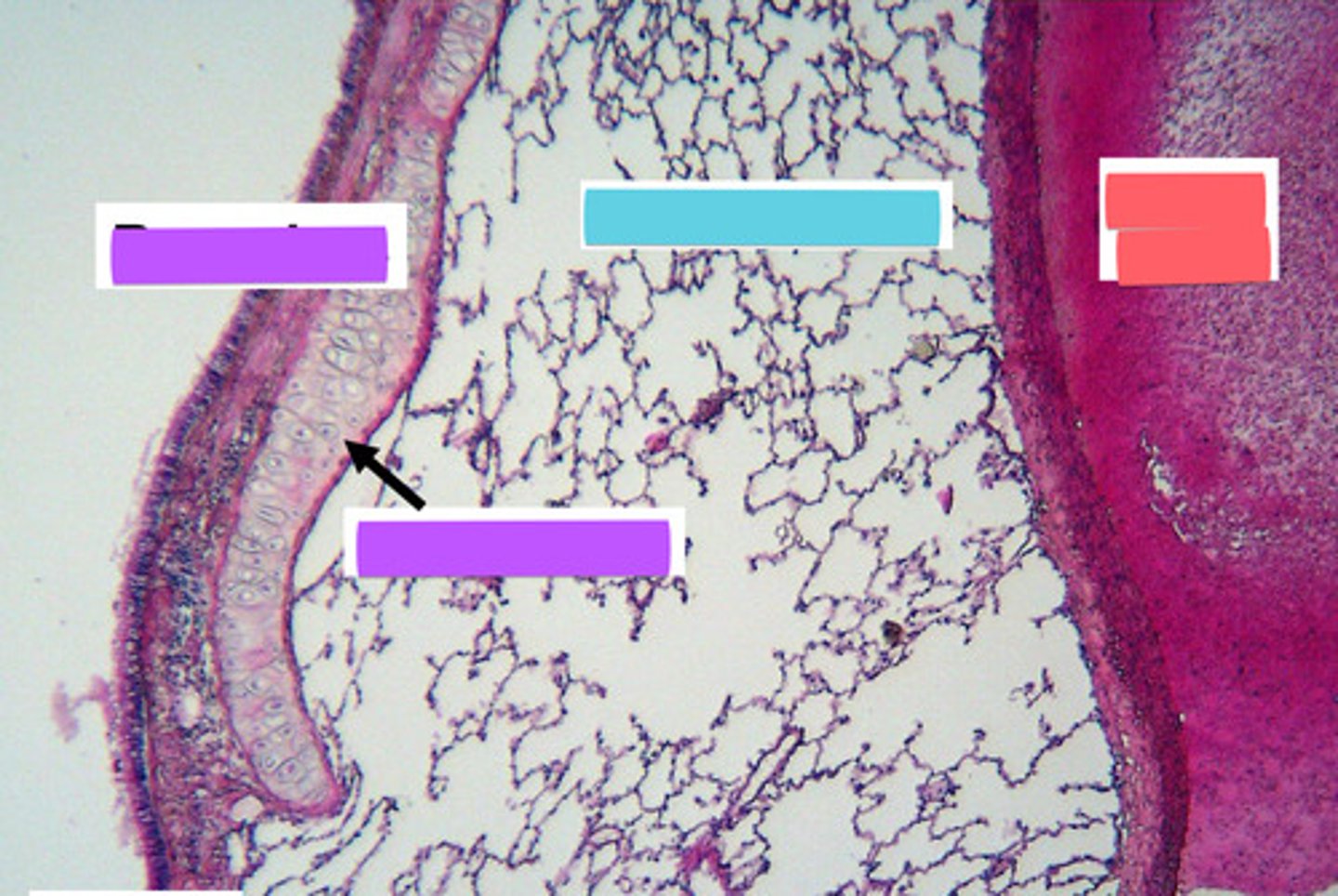 <p>purples are different things</p>