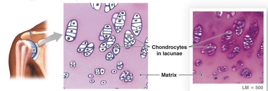 <ul><li><p>flexible and resilient </p></li><li><p>collagen only fiber </p></li><li><p>spherical chondrocytes </p></li><li><p>lacuna of cavity in matrix contains chondrocyte </p></li><li><p>synovial joints </p></li></ul><p></p>