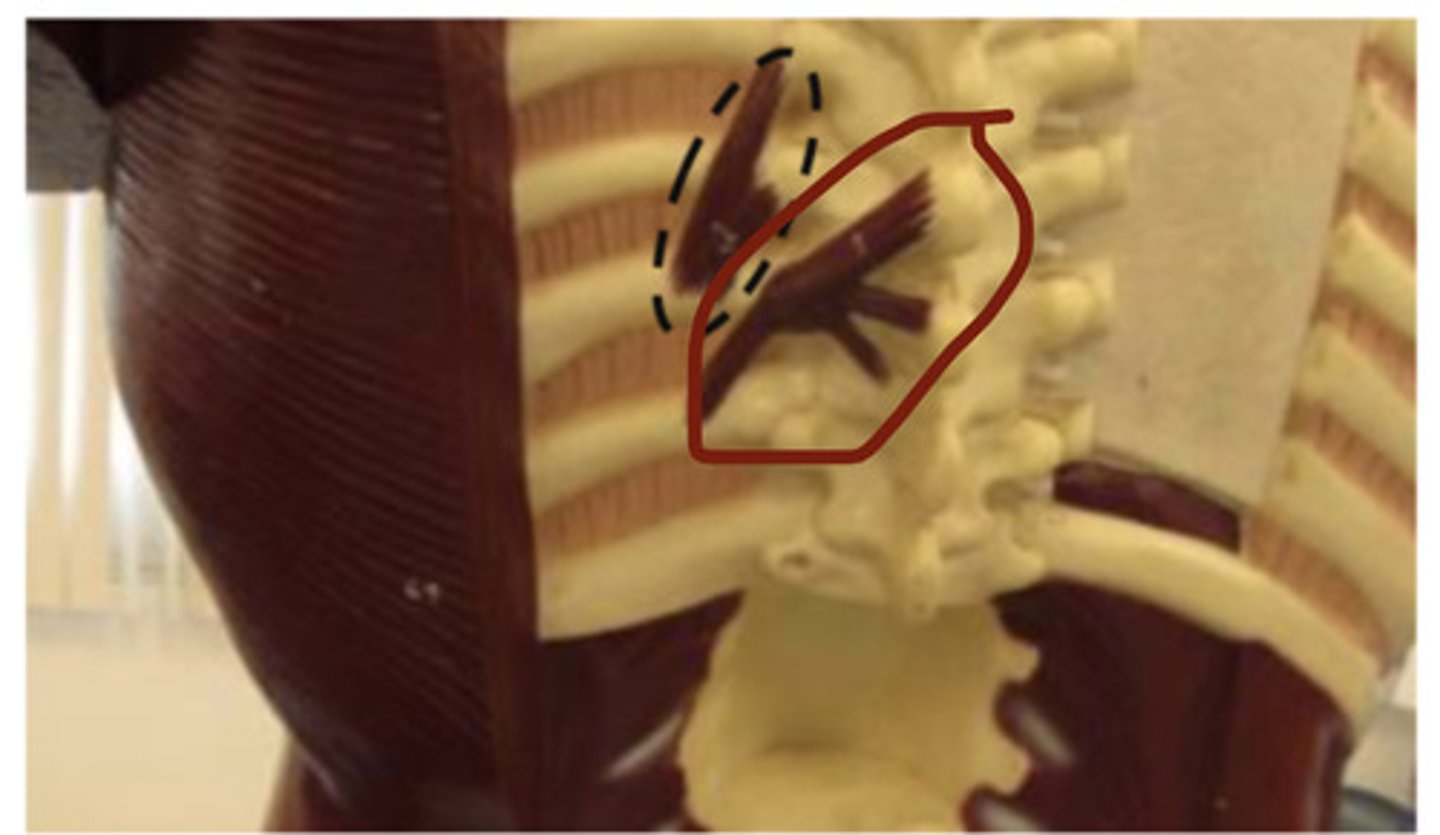 <p>model near sink (found on the lamina of the vertebral column?)</p>
