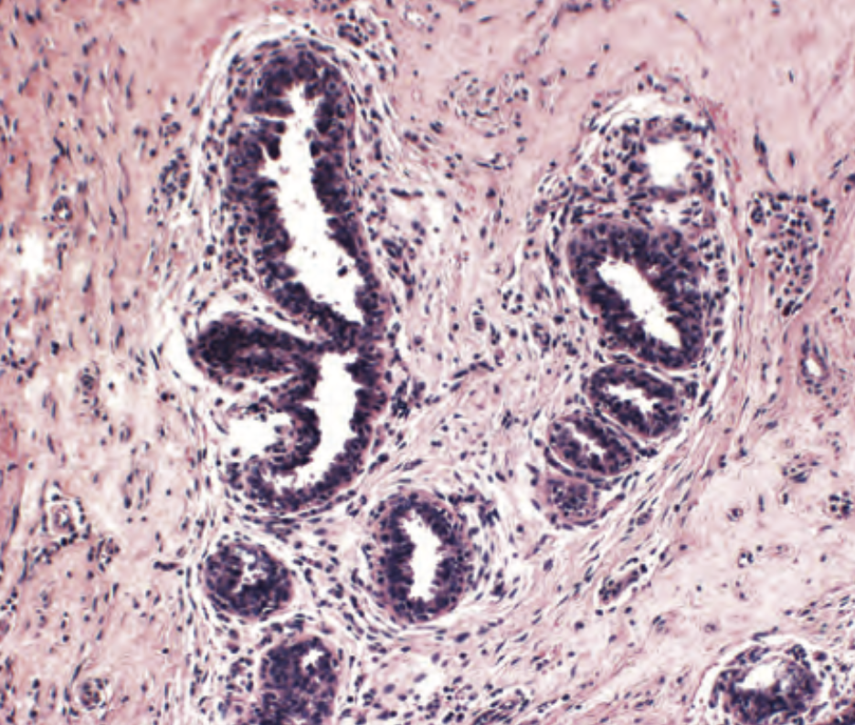 <p>diagnostico </p>