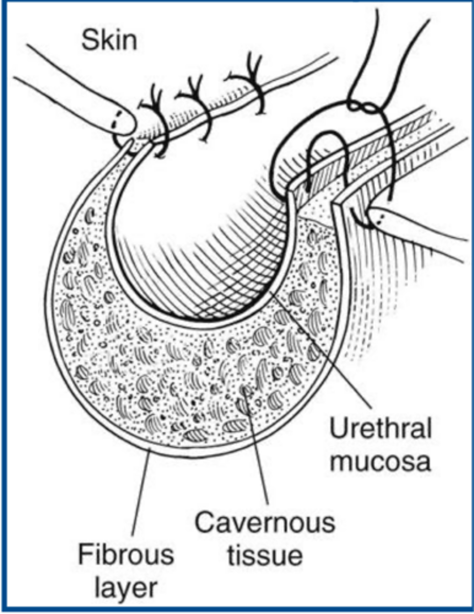 <p>what is notable about canine perineal urethrostomy</p>