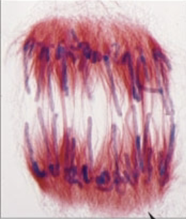 <p>what stage of mitosis?</p>