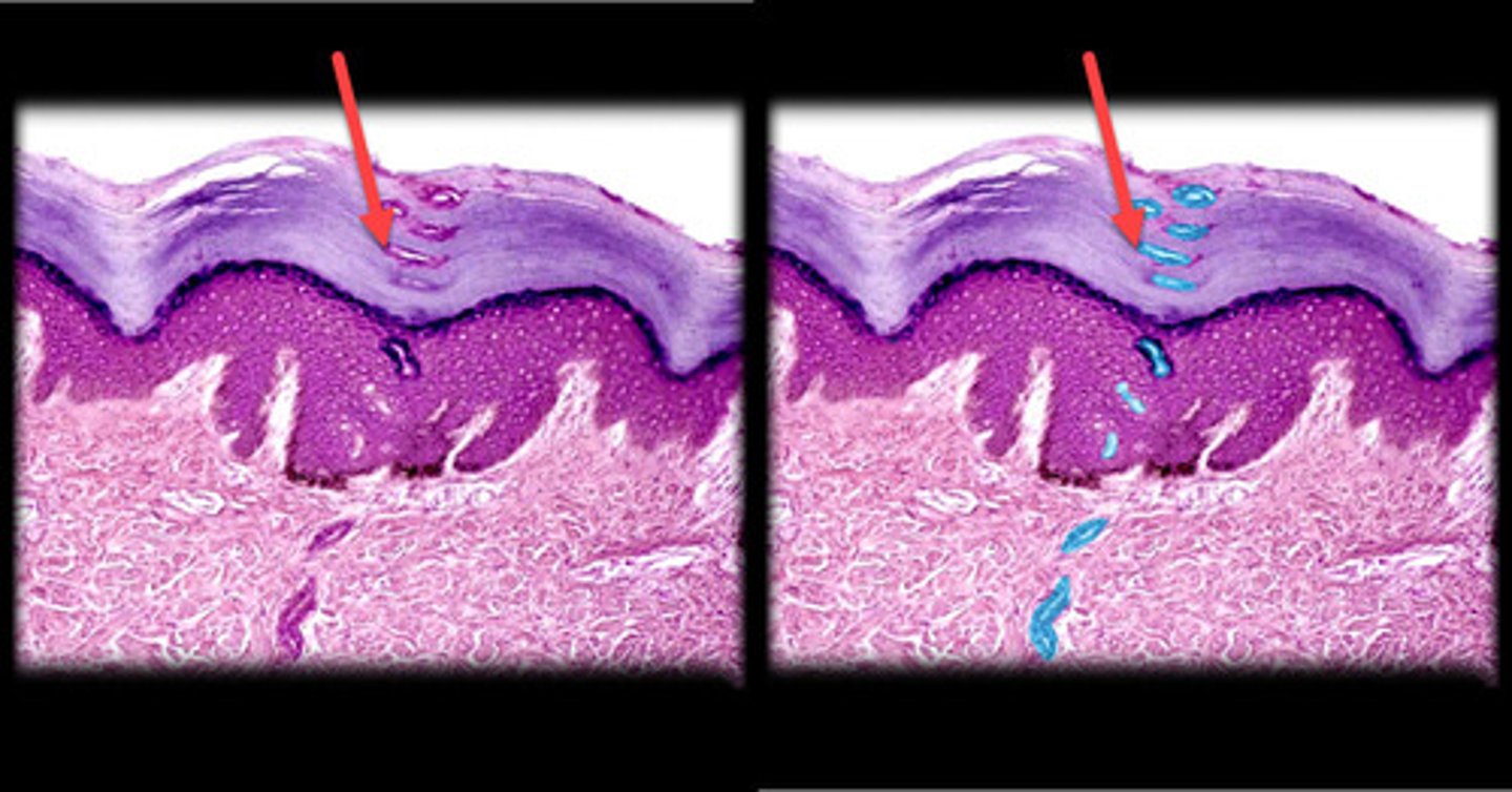 <p>- Simple, coiled tubular glands.</p><p>- Appear as tightly coiled ducts with small, dark-stained cells and a visible lumen in cross-section.</p><p>- Found throughout the skin, especially in areas like the palms, soles, and forehead.</p><p>- Primarily involved in thermoregulation and producing watery sweat.</p>