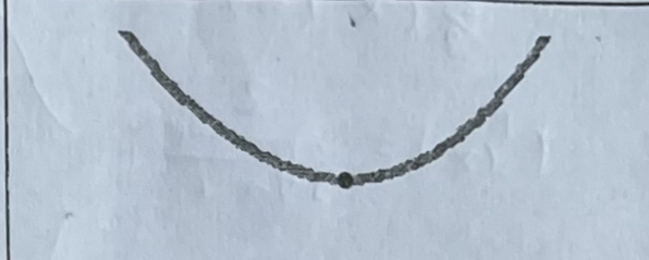 Local Minimum (with Horizontal Tangent)