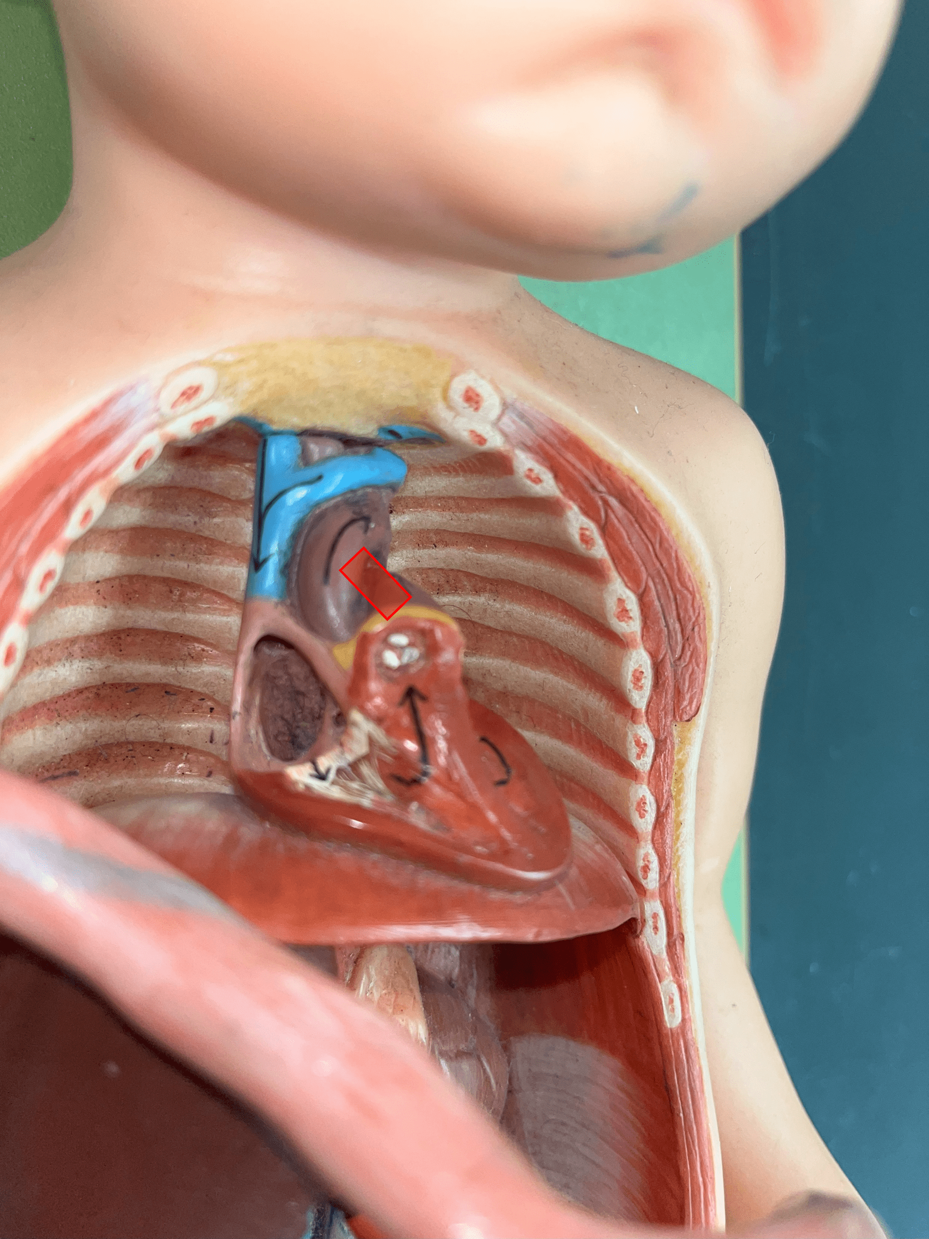 • Part of the fetal circulation.

• Shortcuts blood from the pulmonary trunk to the aorta, bypassing the pulmonary circuit.

• Becomes the ligamentum arteriosum.
