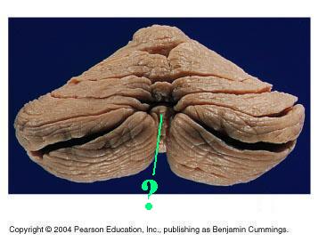 <p><span><span>Identify the indicated lobe of the cerebellum</span></span></p>