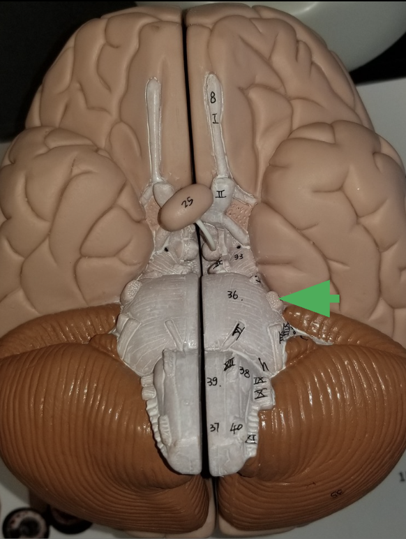 <p>What is the arrow indicating? </p>
