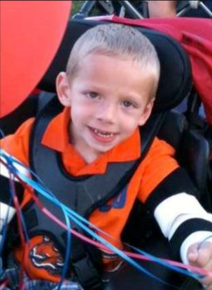 <p>genetic deficiency of the HPRT enzyme</p><p>CHARACTERIZED BY:</p><p>- spasticity</p><p>- chorea</p><p>- athetosis</p><p>- dystonia</p><p>- compulsive self-injurious behavior</p><p>(ex. extreme biting--> some have teeth pulled)</p>