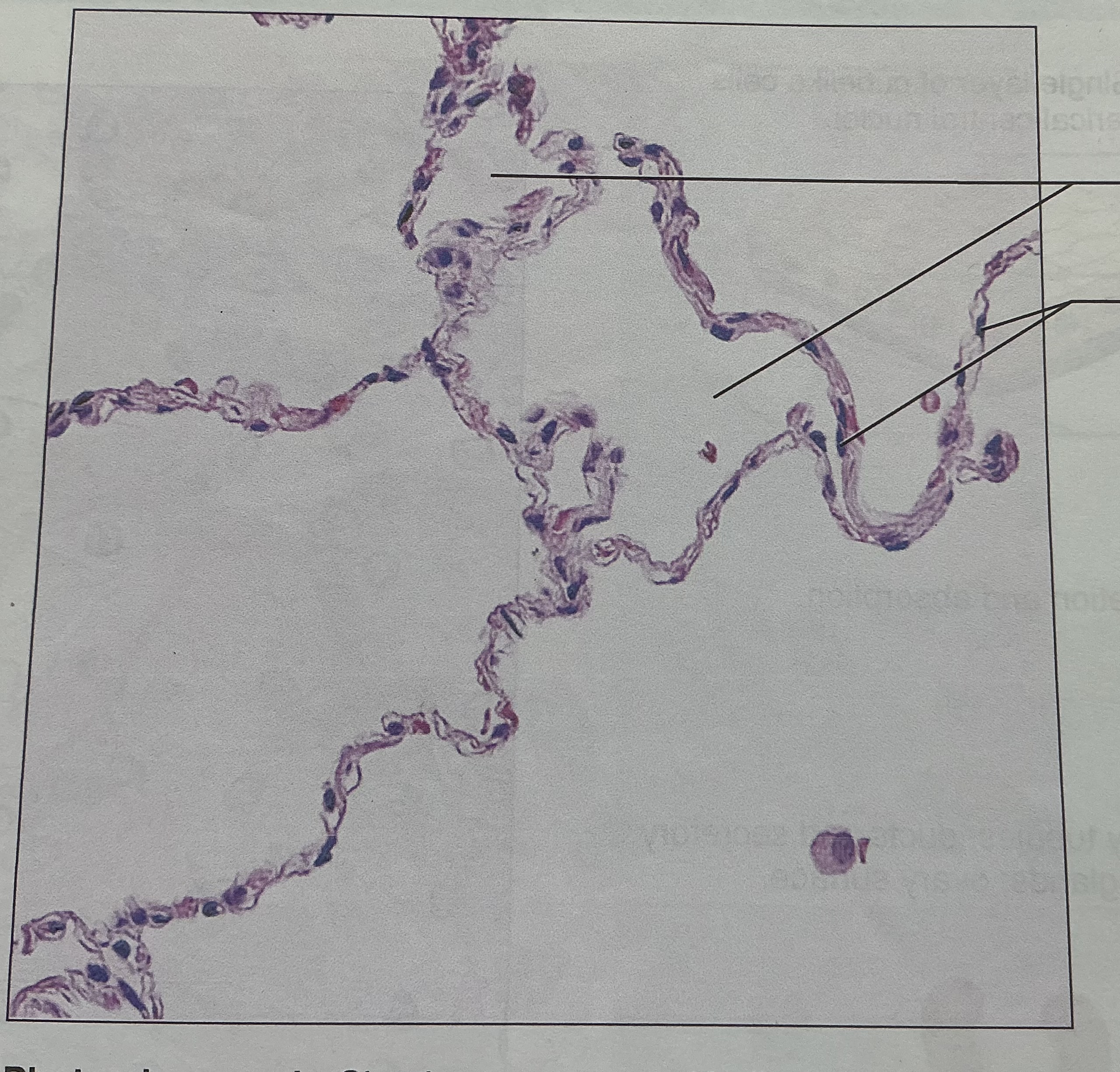 <p>What types of tissue is this </p>