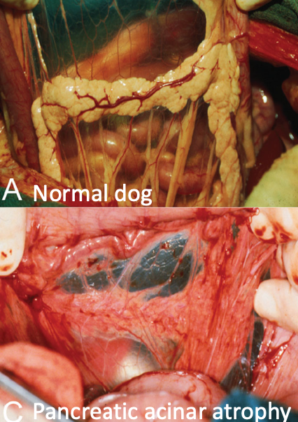 <p>pancreatic acinar atrophy</p><p>tends to develop at a younger age</p>