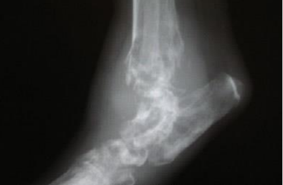 <p>Identify the tumour.</p>