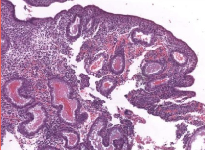what phase of endometrial cycle