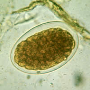 <p>The egg shown below is the diagnostic state of an important parasite found in Puerto Rico and some other islands in the West Indies and in parts of northern South America and Africa. This helminth infects humans by:<br></p><p>Ingestion of the embryonated egg</p><p>Ingestion of the encysted larvae</p><p>Larval penetration of the skin</p><p>Vector injection of infective larvae</p><p>None of the above</p>