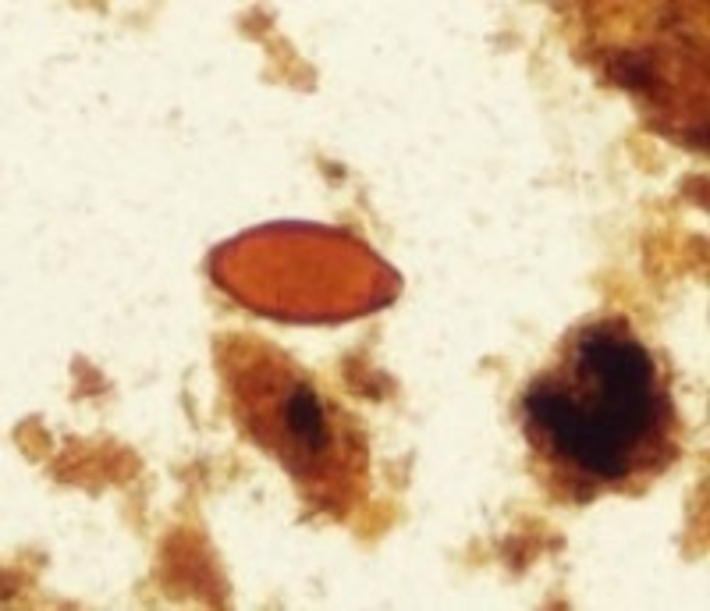 <p>Identify the parasite</p>