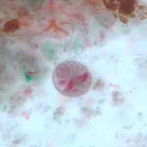 <p>Trichrome Stain</p>