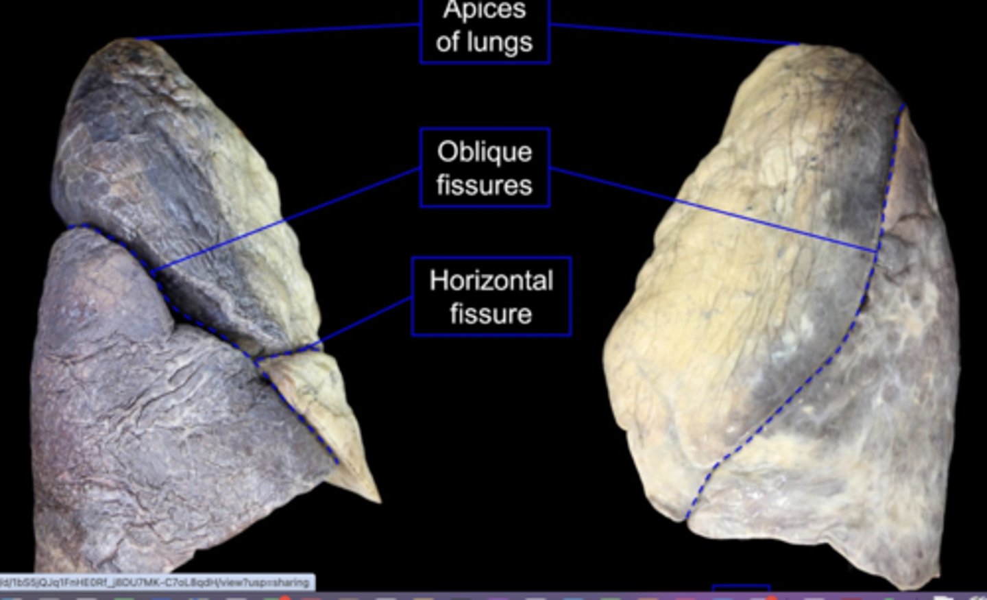 <p>separates superior and inferior lobes</p>