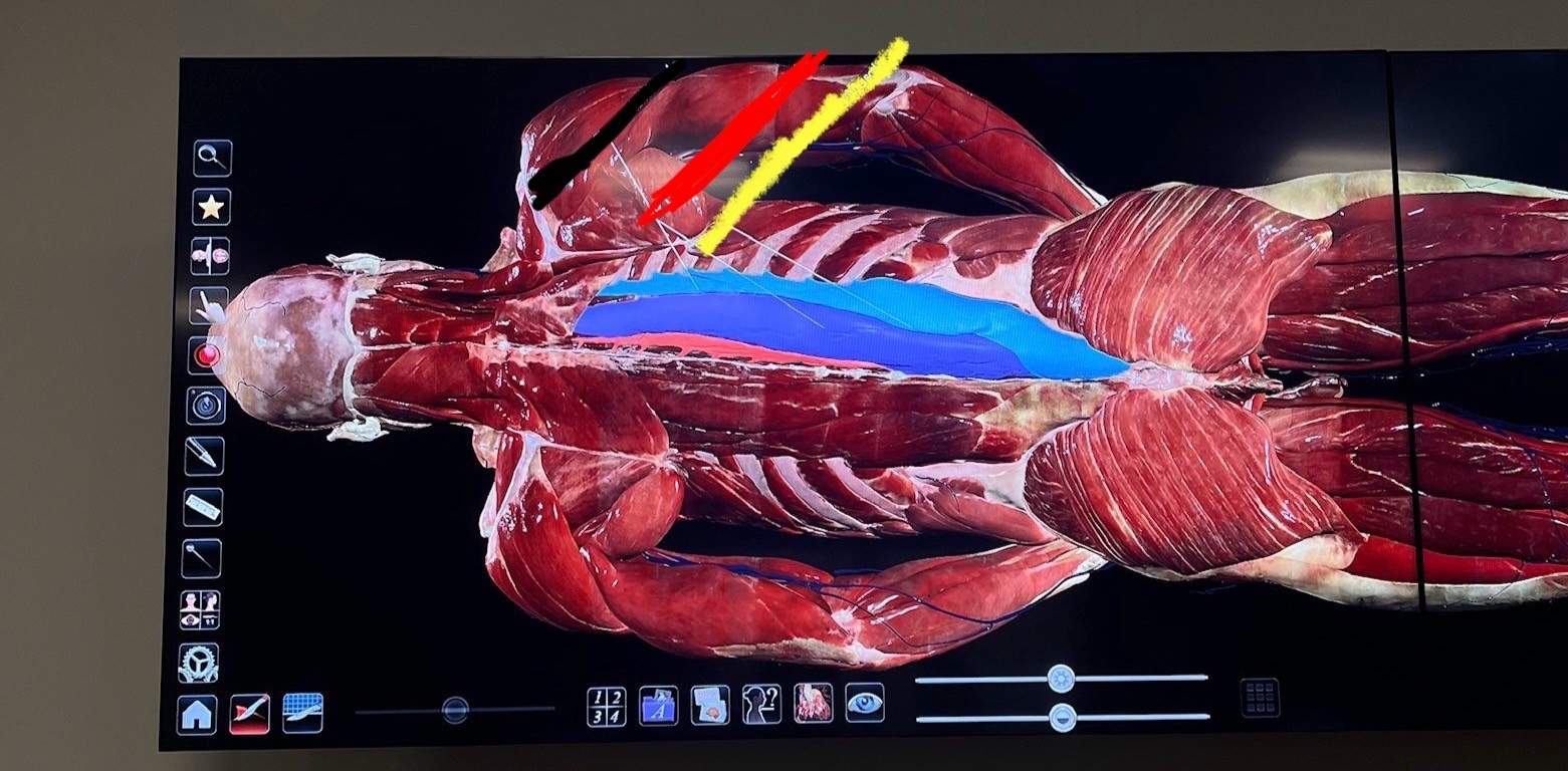 <p>What spinal muscle is highlighted in teal</p>