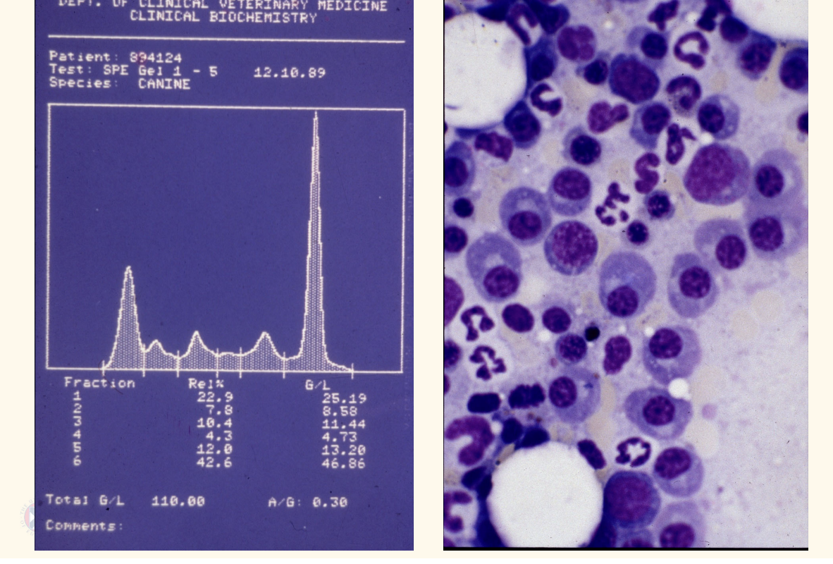 <p>BM aspirate: plasma cell</p><p>PCR</p>