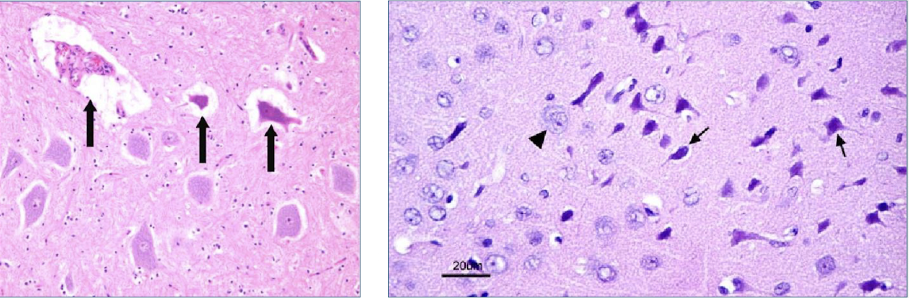 <p>dark neurons</p>