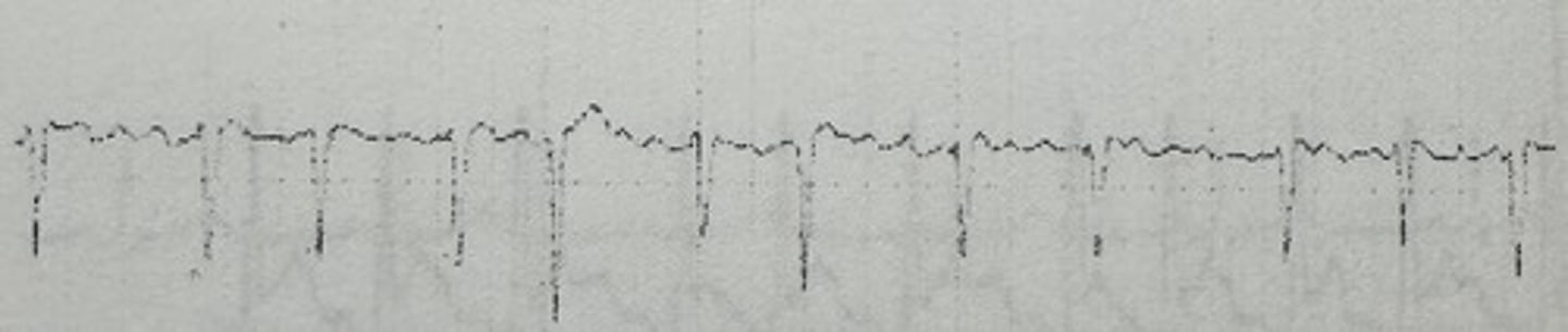<p>identify the rhythm</p>