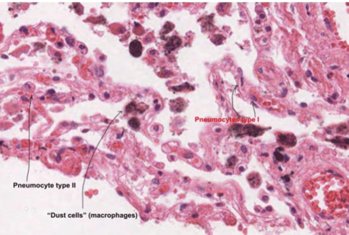 <p>can also act as progenitor cells, replacing damaged Type I pneumocytes when needed. They are critical for alveolar repair and regeneration.</p>