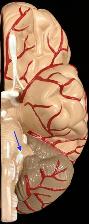 <p>What is the cranial nerve and roman numeral?</p>