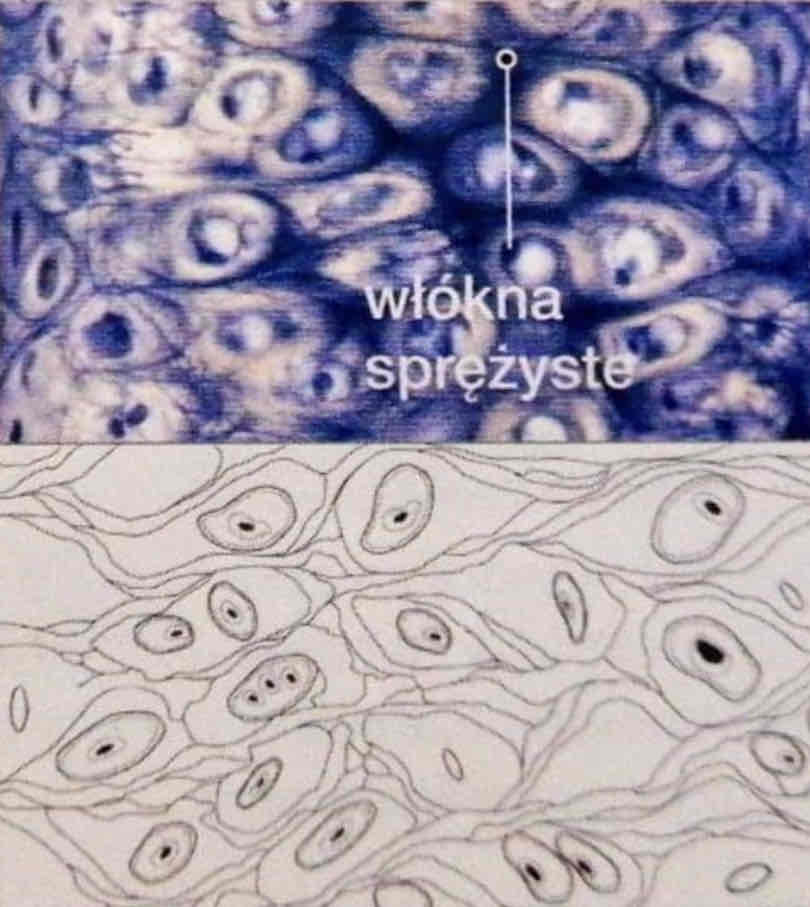 <p>Jaki to rodzaj tkanki chrzęstnej? Podaj cechy jej budowy.</p>