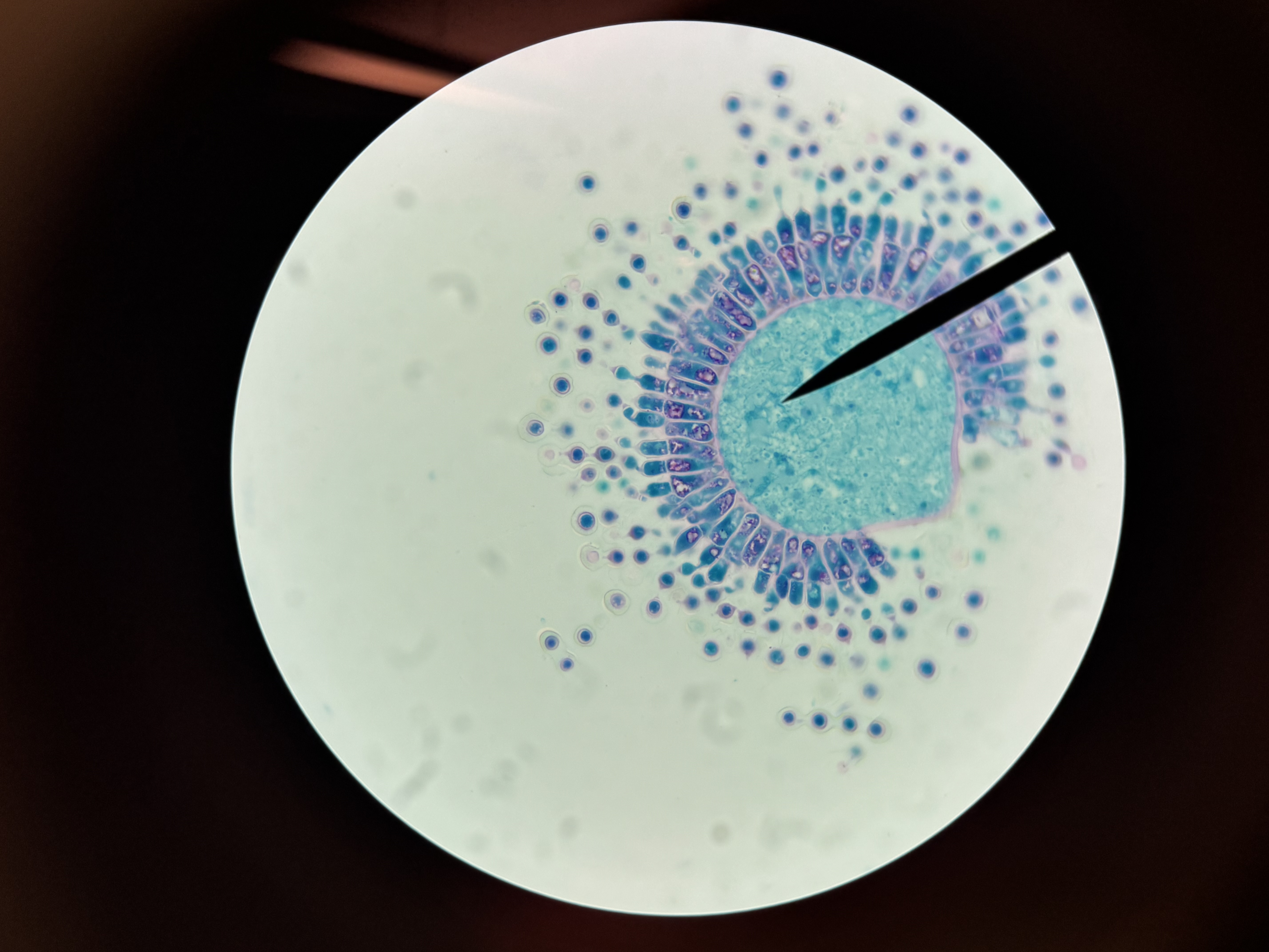 <p>Aspergillus conidiophores</p>