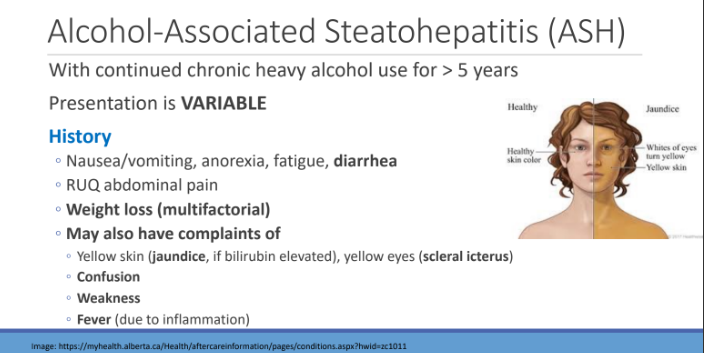 <ol><li><p>Nausea/vomiting, anorexia, fatigue, diarrhea</p></li><li><p>RUQ abdominal pain</p></li><li><p>Weight loss (multifactorial)</p></li><li><p>May also have complaints of</p></li></ol><ul><li><p>yellow skin (jaundice, if bilirubin elevated), yellow eyes (scleral icterus)</p></li><li><p>Confusion</p></li><li><p>Weakness</p></li><li><p> Fever (due to inflammation)</p></li></ul><p></p>