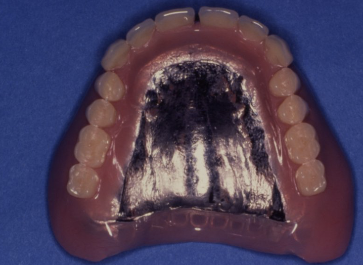 <p>what does this image show and what is a disadvantage of it</p>