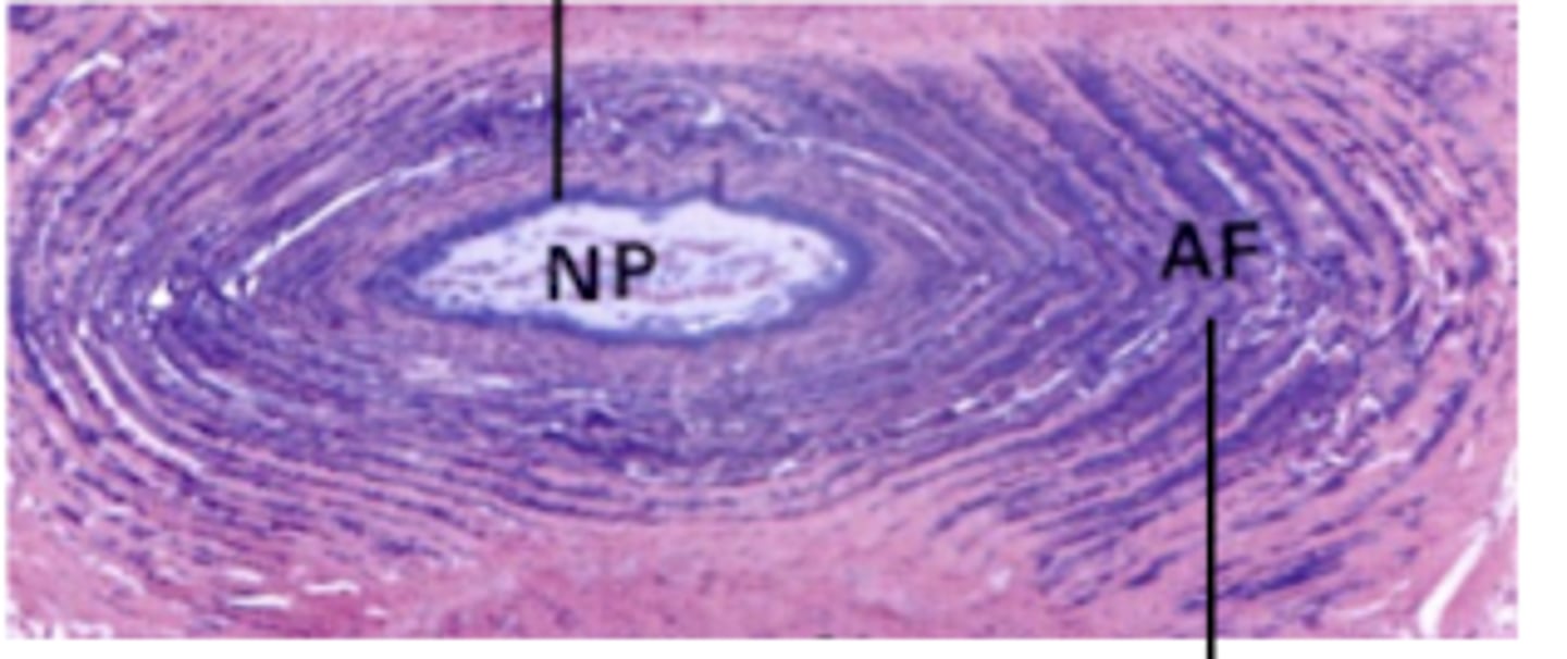 <p>What does the NP stand for?</p>